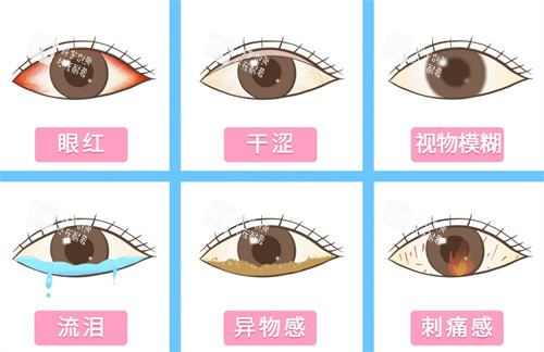 干眼癥的表現(xiàn)