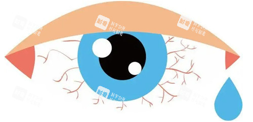 干眼癥卡通圖片