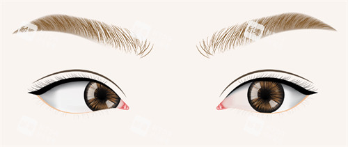 斜視眼睛和正常眼睛