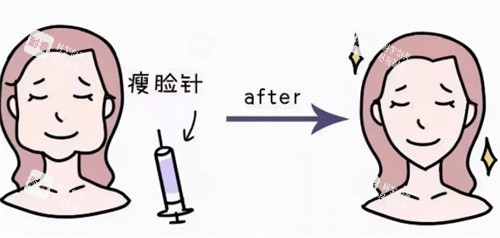 瘦臉注射前后卡通