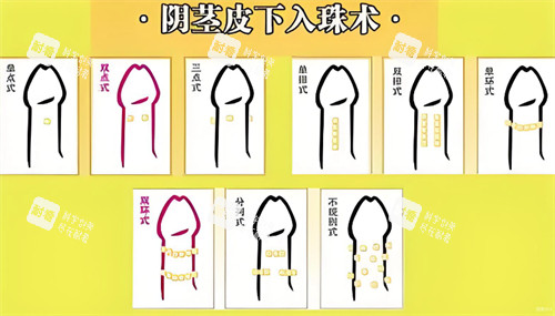 陰莖皮下入珠術