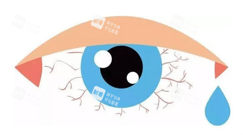 眼睛干澀