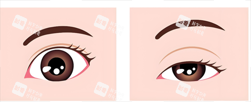 眼睛形態(tài)