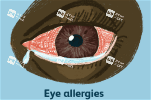 眼睛過敏