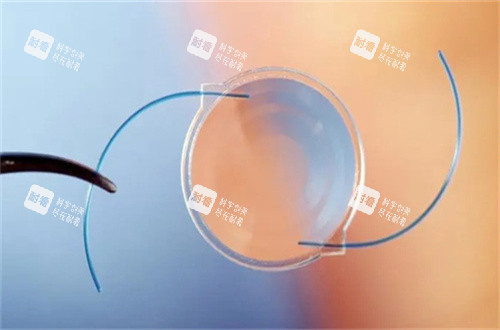 白內障人工晶體