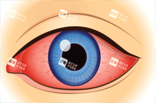 眼睛通紅