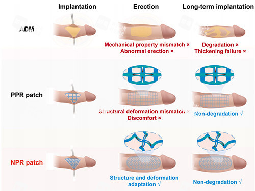 男性玻尿酸增大治療價格大公開！2000元起，結(jié)果能維持多久？一文說清楚！