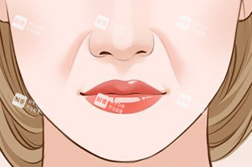 面部法令紋卡通示意圖