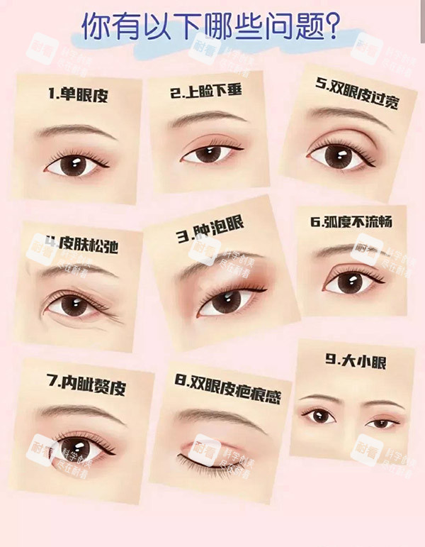 雙眼皮類型圖片