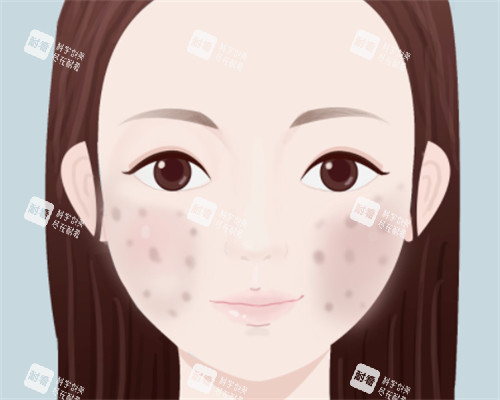 臉上痘印怎么辦