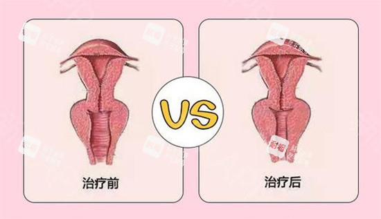 廣州私密整形哪家好？預(yù)算8K，面診荔灣齊云香1212起/高尚，透明定價(jià)vs隱私化服務(wù)！