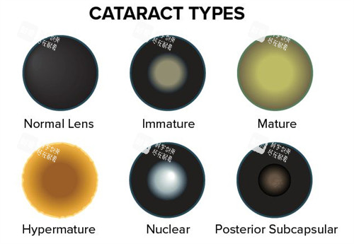 不同眼睛問(wèn)題