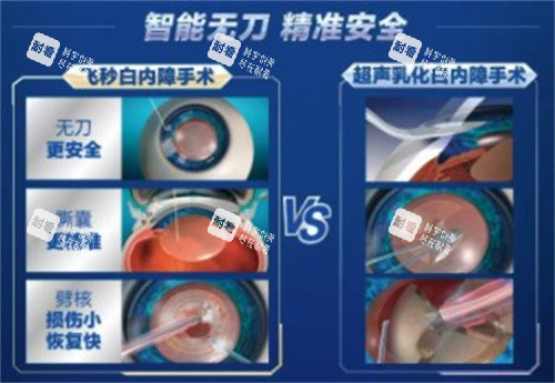 愛爾眼科白內(nèi)障手術