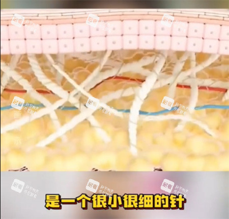 私密緊致針好不好