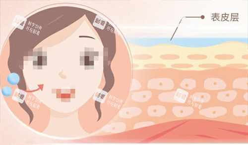 玻尿酸面部注射動(dòng)畫(huà)以及皮膚表面