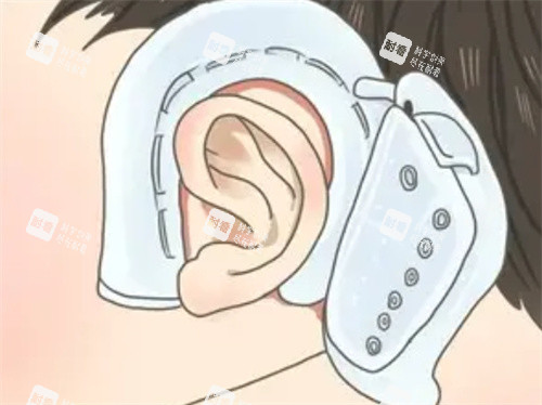 耳朵矯正器的形狀