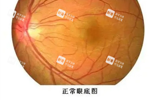 近視眼手術(shù)宣傳圖