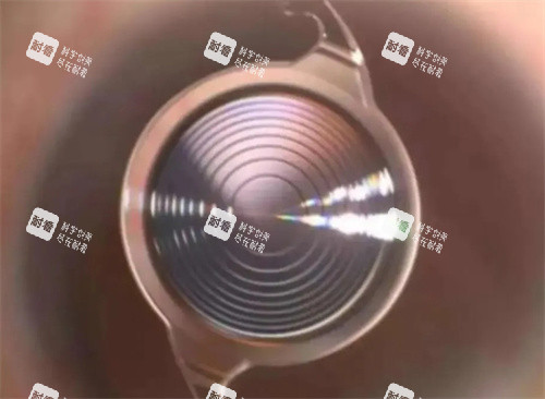 無(wú)極變焦人工晶體