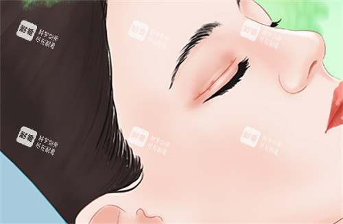 需要雙眼皮修復(fù)的眼睛