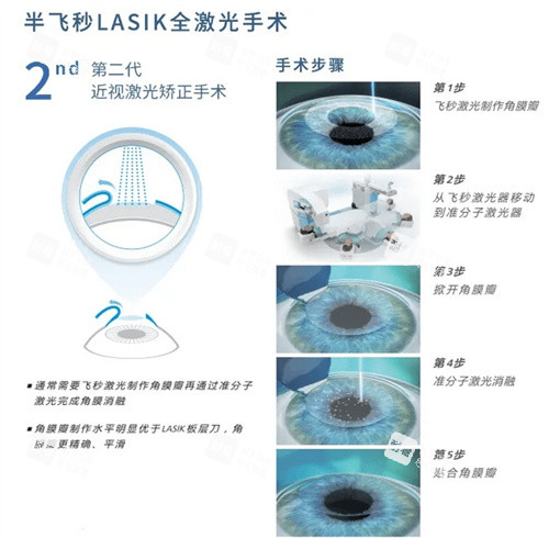 東莞華廈眼科技術(shù)優(yōu)勢？超突出！全飛秒小創(chuàng)口術(shù)式創(chuàng)傷小，兒童視光防控體系完善，選擇多樣