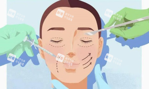 雙眼皮手術(shù)操作示意圖 雙眼皮手術(shù)操作示意圖