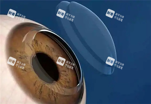 角膜塑形鏡佩戴圖