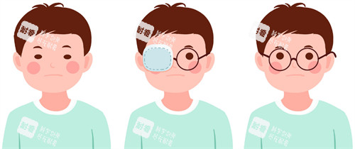 眼睛弱視矯正 眼睛弱視矯正