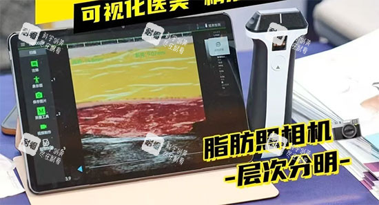 維密金雕實(shí)物設(shè)備圖片