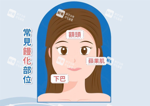 饅化臉常見部位 饅化臉常見部位