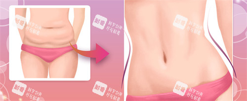 崔鑫醫(yī)生腹壁成形手術(shù)怎么預(yù)約？超順暢！線上官網(wǎng)+客服對(duì)接，快速鎖定手術(shù)檔期，享專(zhuān)屬面診