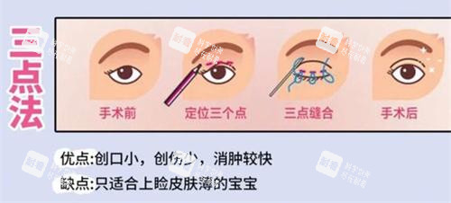 威海榮成睿辰醫(yī)療美容門(mén)診部口碑好不好？超贊！輕醫(yī)美項(xiàng)目結(jié)果顯著，收費(fèi)透明無(wú)隱形消費(fèi)，回頭客多