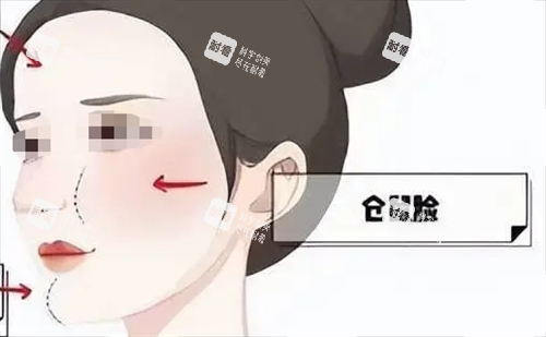 玻尿酸后饅化現(xiàn)象動(dòng)畫(huà)展示