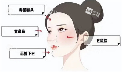 北京王闊遠(yuǎn)治療饅化臉怎么樣？治療饅化臉技術(shù)成熟，精細(xì)化修復(fù)自然無(wú)痕