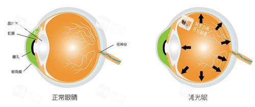 北京大學(xué)人民醫(yī)院眼科醫(yī)生在線預(yù)約，北京大學(xué)人民醫(yī)院眼科中心掛號(hào)預(yù)約流程