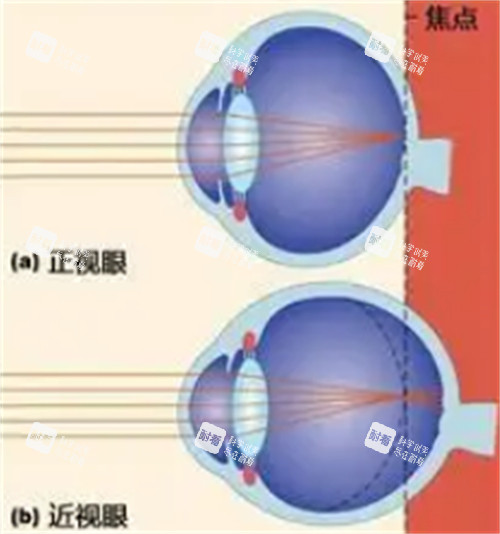 正常眼睛和近視眼鏡的不同