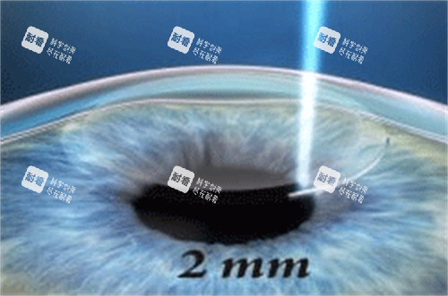 上海私立眼科醫(yī)院價格差距咋這么大？曜影醫(yī)療貴是貴但服務確實頂！