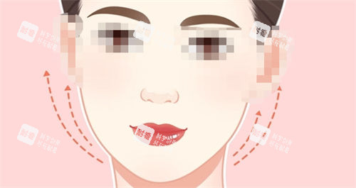 郭玉瑞小拉皮什么價位？小拉皮手術(shù)1.5w元起，收費(fèi)透明無隱形消費(fèi)性價比高